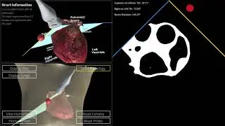 APIL Cardiac Ultrasound Simulator