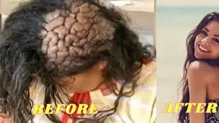 HER BRAIN STARTED TO GROW OUTSIDE MOM LOOKS CLOSER AND CALLS THE DOCTOR