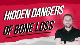 Revealing the Hidden Dangers of Bone Loss: All-on-4 Dental Implants