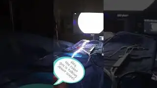 Inside the Operating Room for Meniscus Repair 