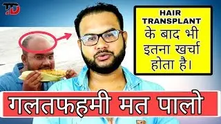 HAIR TRANSPLANT के बाद भी कितना खर्चा होता है। cost of hair transplant ।#TANNUDADA