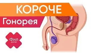 ГОНОРЕЯ Лечение | КОРОТКО | Как вылечить гонорею дома за 1 минуту | Симптомы | Как быстро вылечить