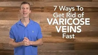 7 Ways to Get Rid of Varicose Veins Fast | Dr. Josh Axe