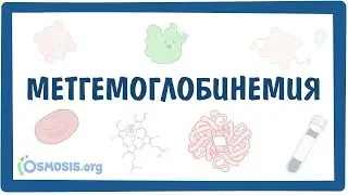 Метгемоглобинемия — причины, симптомы, патогенез, диагностика, лечение