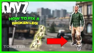 DayZ - How to Fix a Broken Leg (Survival Guide)