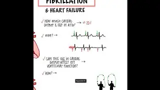 Sam from Dontmissabeat.ig discusses afib and cardiac output