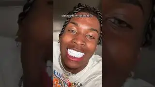 How To Get The Whitest Teeth In The World! 😬🦷