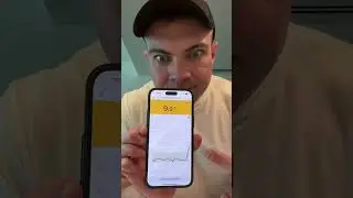 Гликимический индекс 