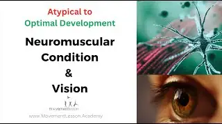 Atypical Development Baby Neuromuscular Condition and Vision