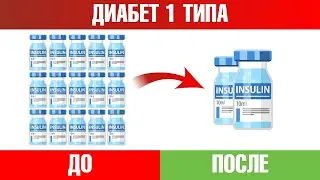 Диабет 1 типа👉Все, что нужно знать для снижения дозы инсулина