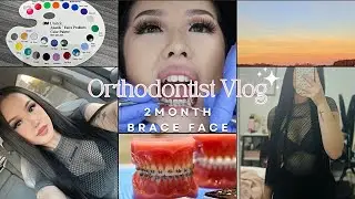 Braces Vlog Ep.4: 2 MONTH BRACES UPDATE + Orthodontist vlog