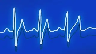 Can one frequency distort another?
