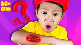 Why do we have scabs + More Nursery Rhymes and Kids Songs