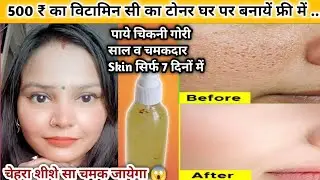 WOW 😮 अब चेहरा बिल्कुल साफ👌 | 7 दिन तक चेहते पर लगालो स्किन बेदाग होकर चमकेगी #skincare #toner #diy