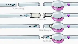 How Does Birth Control Work?