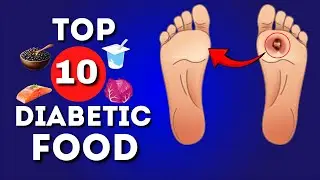 TOP 10 Anti-Diabetes Foods Hiding in Plain Sight