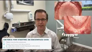 ENCOMPASS Step 1: Guidelines and Case Workup for Zest ENCOMPASS - All in One Overdenture Solution