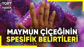 Dünyada Maymun Çiçeği Alarmı Verildi! İşte Hastalığın Spesifik Belirtileri - TGRT Haber