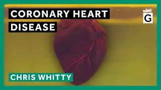 Coronary Heart Disease