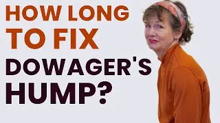 How Long to Correct Dowager’s Hump?