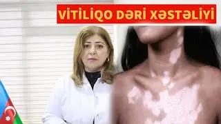 VİTİLİQO DƏRİ XƏSTƏLİYİ HAQQINDA