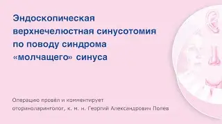 Эндоскопическая верхнечелюстная синусотомия по поводу синдрома «молчащего» синуса