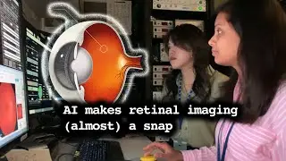 AI makes retinal imaging (almost) a snap