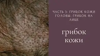 Грибок кожи. Грибок кожи головы. Грибок на лице. Часть 3