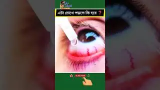 এটা চোখে পড়লে কি হবে #shorts #viral #shortsbeta