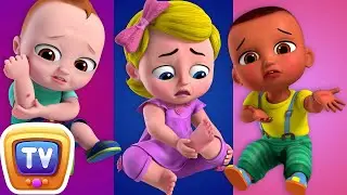 Boo Boo Song - ChuChu TV Baby Nursery Rhymes & Kids Songs