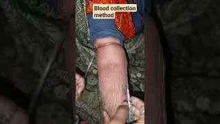 Blood collection method 