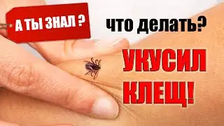 Что делать, если укусил КЛЕЩ  Как вытащить клеща А ТЫ ЗНАЛ