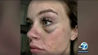 Ex deputy speaks out after jury finds her attacker not guilty