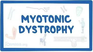 Myotonic dystrophy - an Osmosis Preview