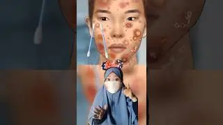 kompilasi kumpulan asmr animasi rawat berbagai luka |Mv 