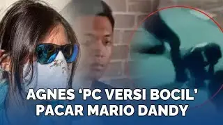 Agnes Gracia Haryanto ‘PC versi Bocil’ Pacar Mario Dandy