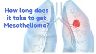 Asbestos Cancer Lawsuit