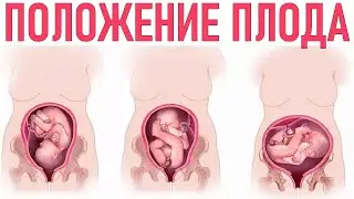 ПРЕДЛЕЖАНИЕ ПЛОДА | Когда ребенок переворачивается вниз головой и что для этого делать