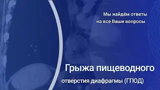 Грыжа пищеводного отверстия диафрагмы