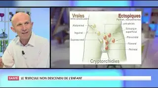 LE TESTICULE NON DESCENDU C'EST QUOI ?