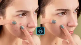How to retouch your skin in photoshop: A beginner's guide