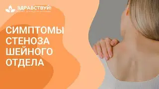 Стеноз шейного отдела симптомы // zdravclinic.ru