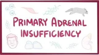 Primary adrenal insufficiency (Addison's disease) - pathology, symptoms, diagnosis, treatment