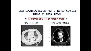 Detect COVID19 from chest CT-scan. Deep Learning algorithm to detect corona from chest CT images.