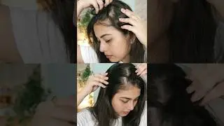 How I reduced my hairfall & got new hair growth | Best solution for Hairfall/ Hairloss/ Hair Growth✨