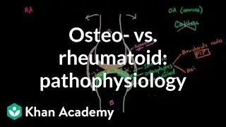 Osteoarthritis vs rheumatoid arthritis pathophysiology | NCLEX-RN | Khan Academy