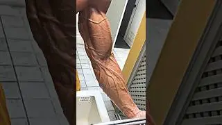 One paper cut … But it’s only skin