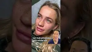Doctor Reacts to Freckle Tattoos! 