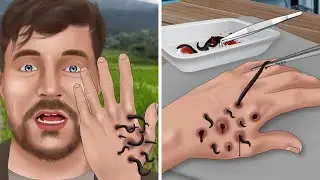 ASMR Help MrBeast Catch leeches from his hands | Be careful when farming | WOW Brain Relax
