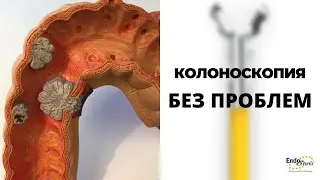 Как делать колоноскопию. Многопрофильная клиника 